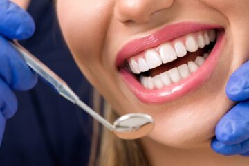 whiten composite bonding