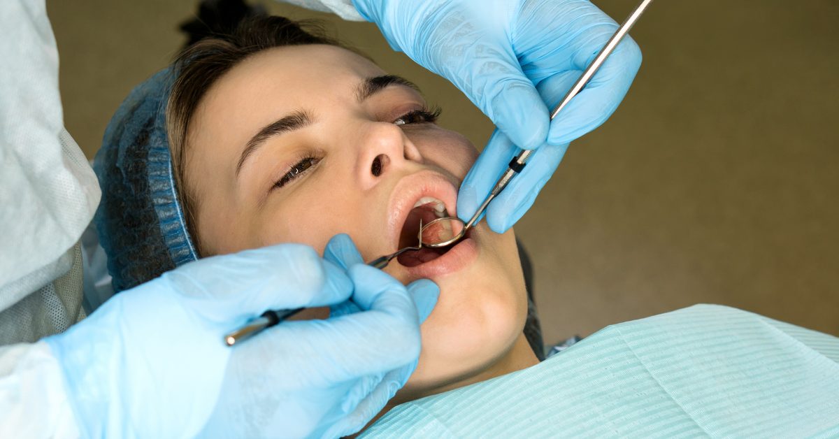 Wisdom Tooth Removal