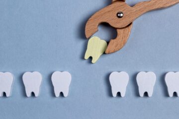 Wisdom Tooth Removal