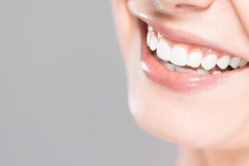 professional whitening