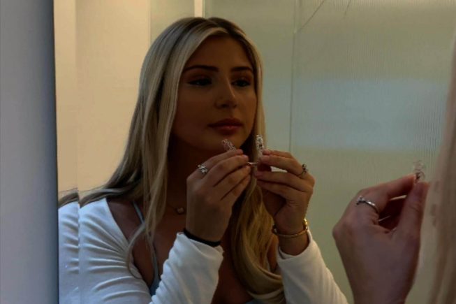 composite-bonding-1-1-1 (1) (1)